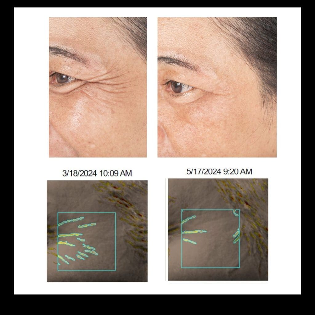 Day-treatment-serum-30-off